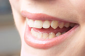 Straighter teeth with Invisalign system in Idaho Falls